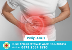 Polip Anus