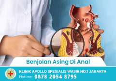 Benjolan Asing di Anal