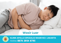 Wasir Luar