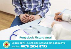 Penyebab Fistula anal