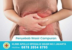 Penyebab Wasir Campuran