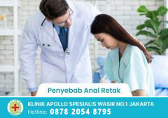 Penyebab Anal Retak