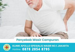 Penyebab Wasir Campuran